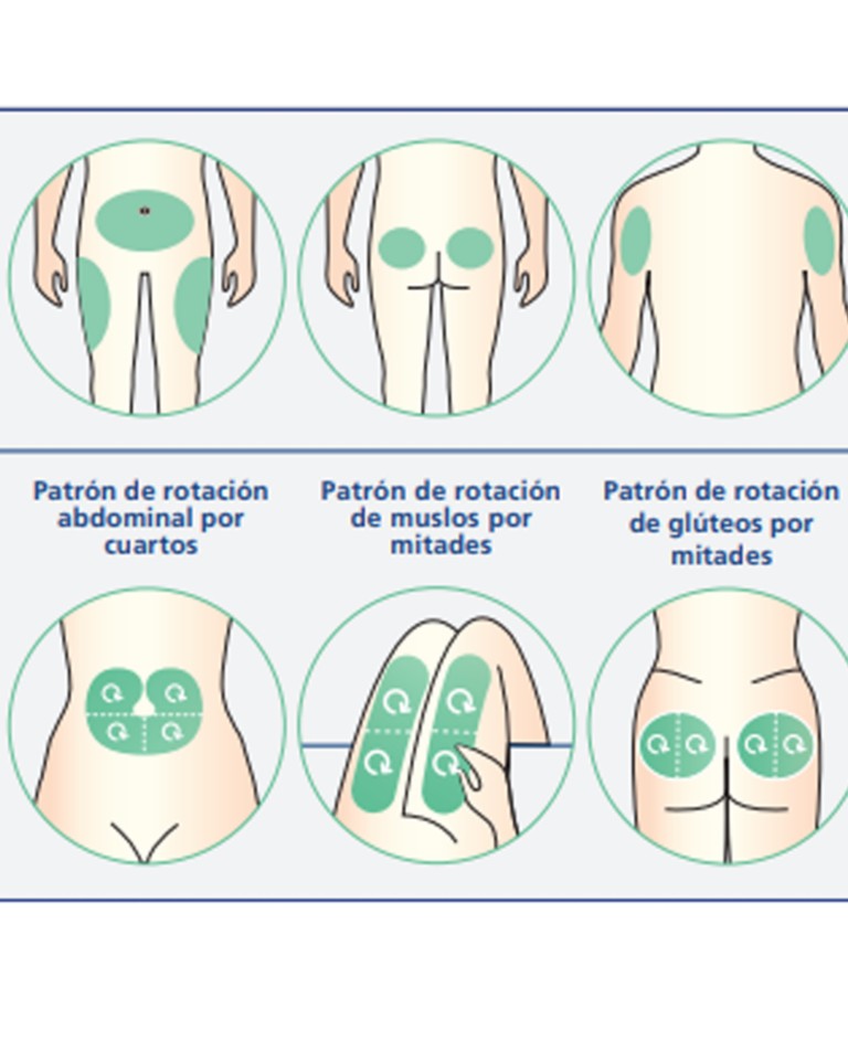 Tarjetón de Aplicación