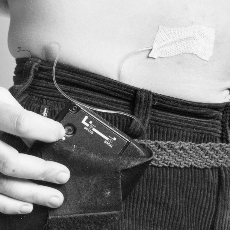 Mid-century insulin pump