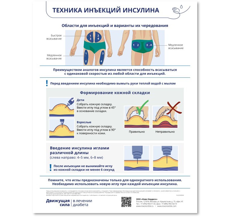В какое место колоть инсулин