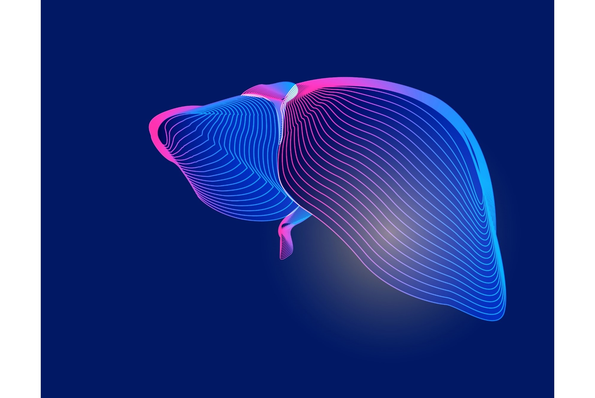 Metabolic Dysfunction Associated Steatohepatitis(MASH)