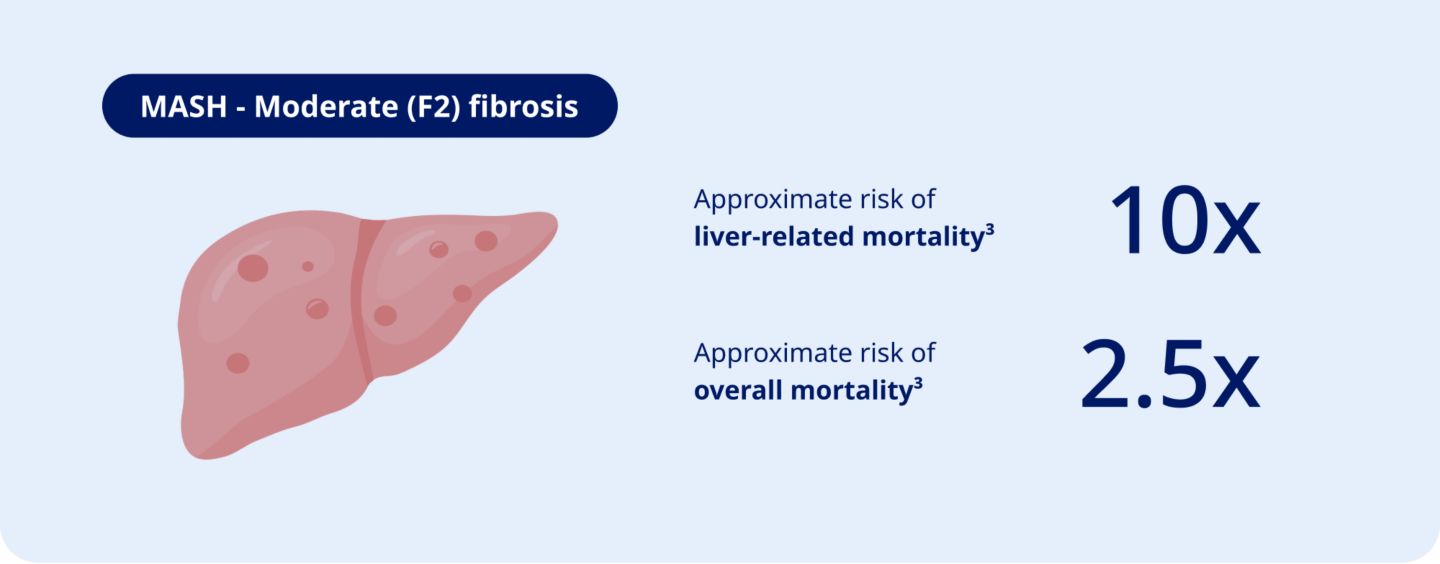 Screen for MASH to prevent serious health risks
