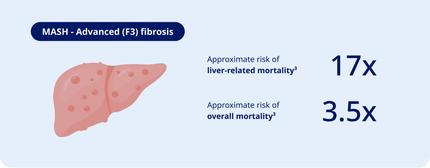 Screen for MASH to prevent serious health risks