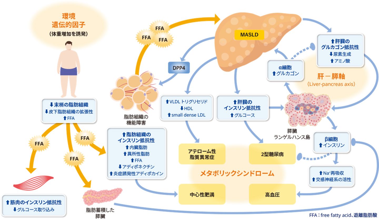 肥満症 | 肥満症とMASLD/MASH | 肥満症に関するトピックス | 医療従事 
