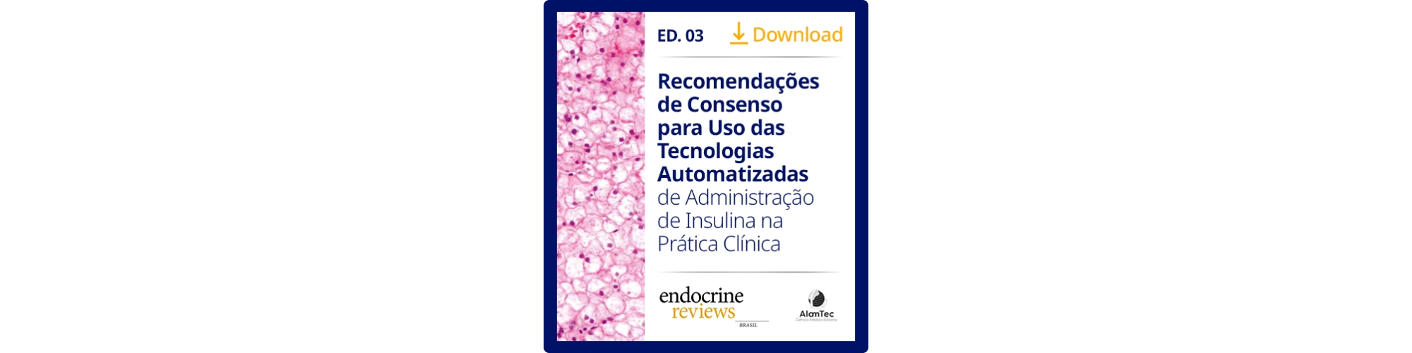 automatizadas