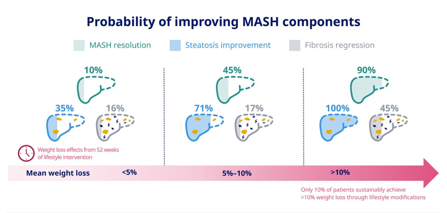 Diagnosis and management of MASH
