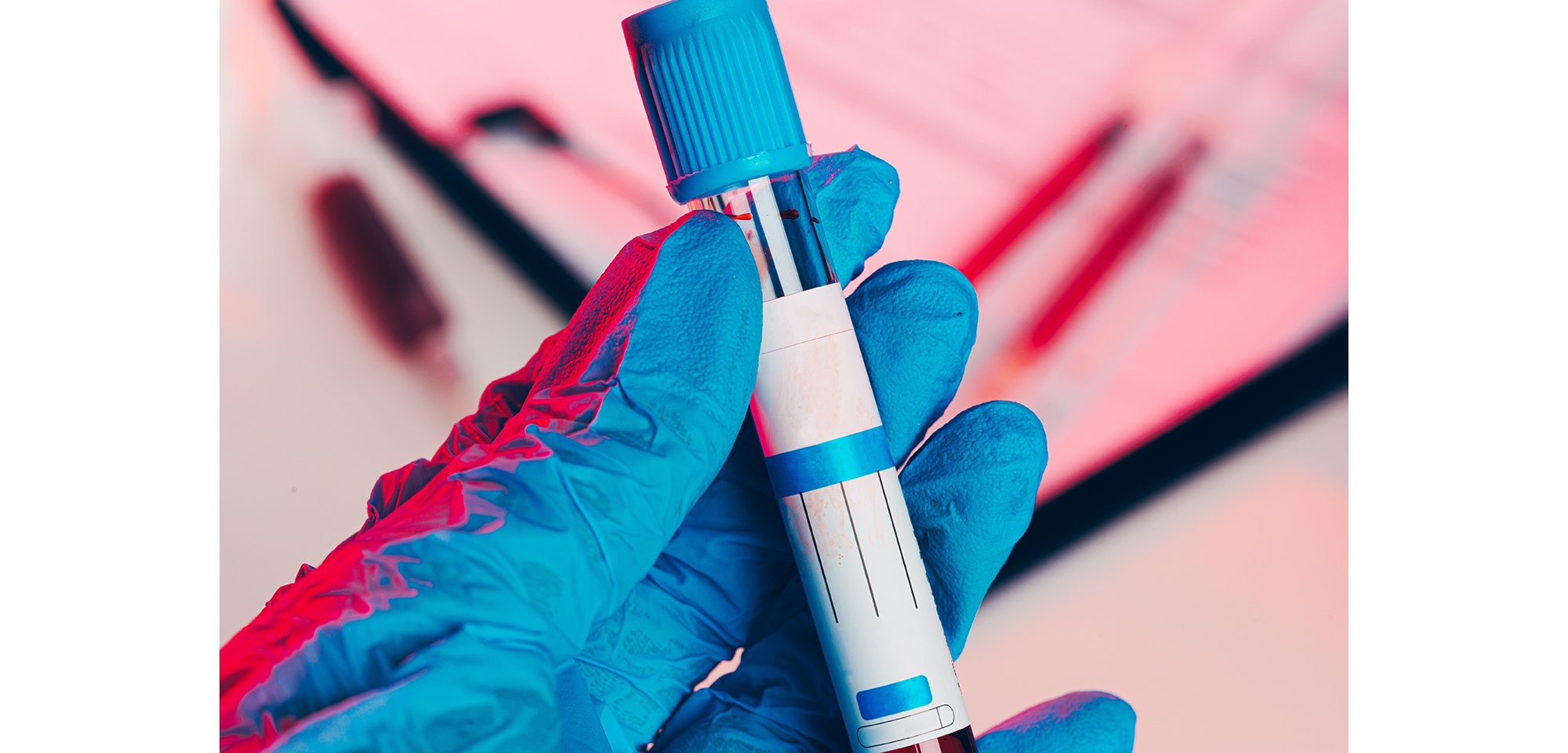 Doctor's hands  in blue gloves keep  test tube with a blood