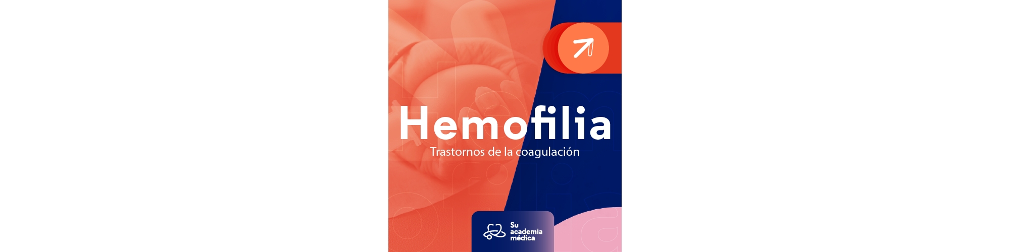 Hemofilia y enfermedades raras. 