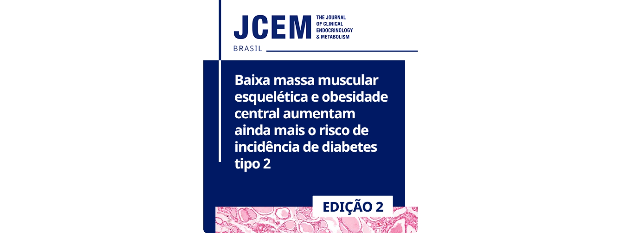 Baixa massa muscular esquelética e obesidade central aumentam ainda mais o risco de incidência de diabetes tipo 2