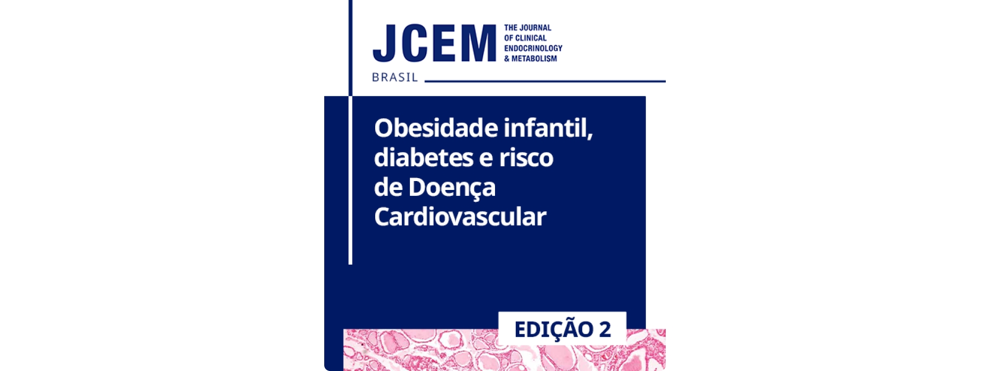 Obesidade infantil, diabetes e risco de doença cardiovascular