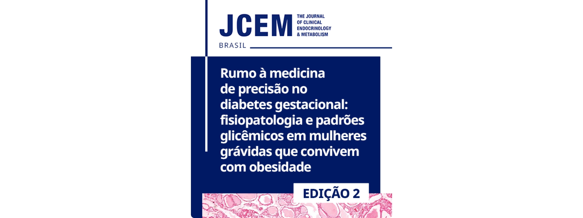 Rumo à medicina de precisão no diabetes gestacional