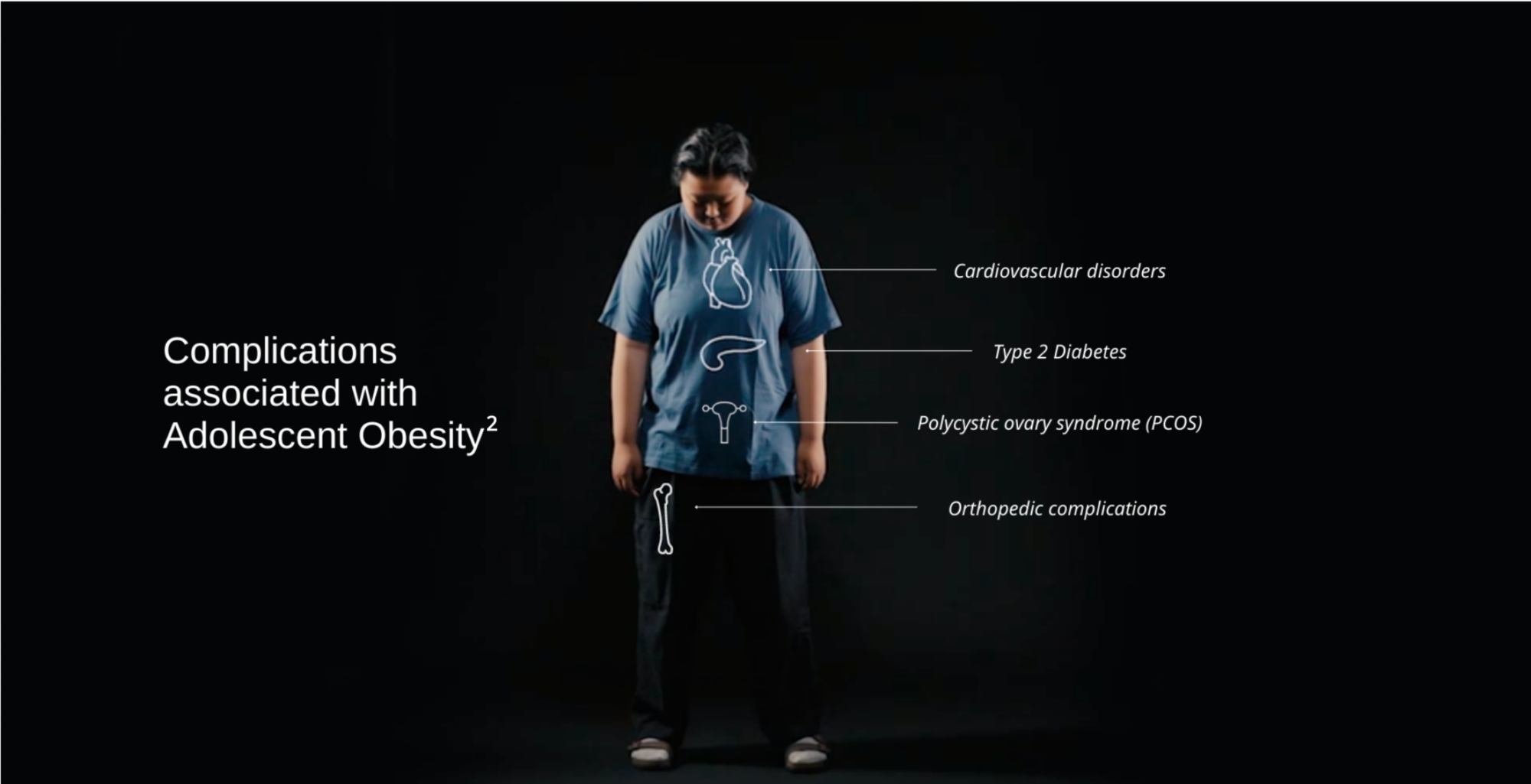 Complications associated with Adolescent Obesity