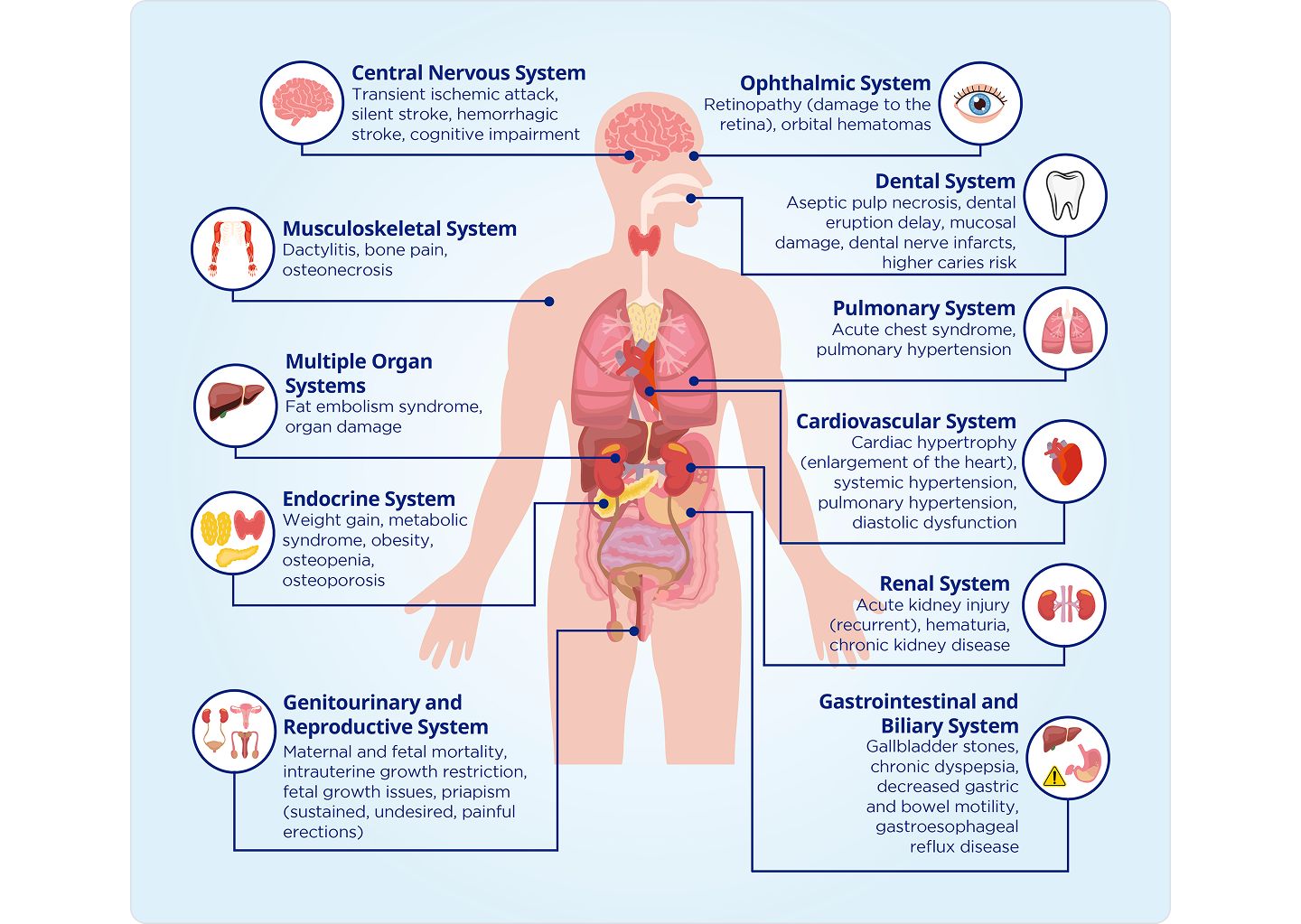 SCD DIAGNOSIS AND SCREENING Detect early | Manage better