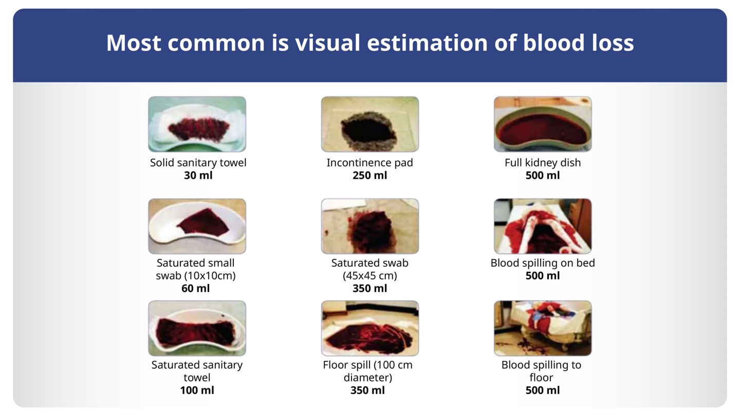 Prevention and Management of PPH